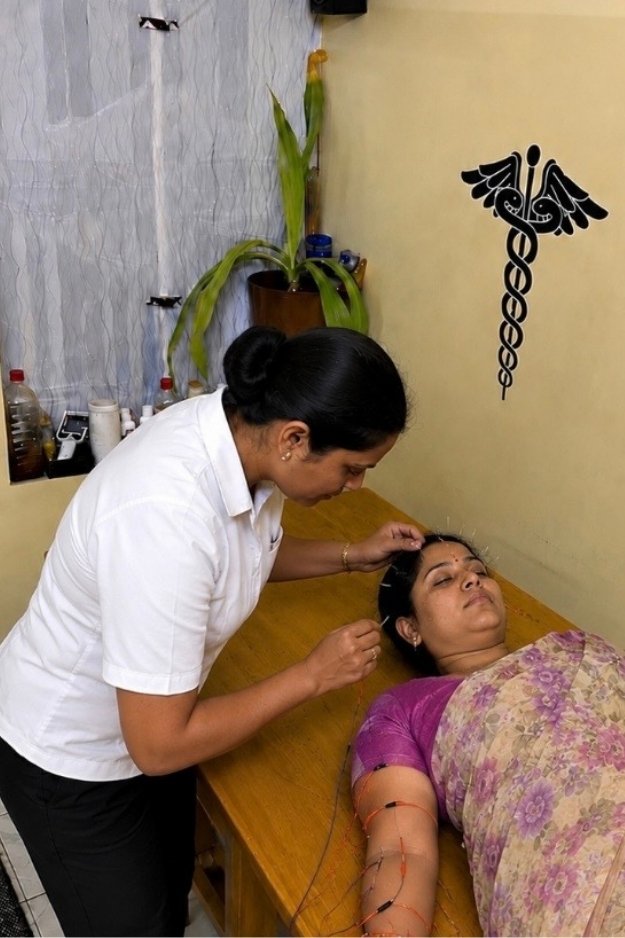 Acupuncture in sivakasi
