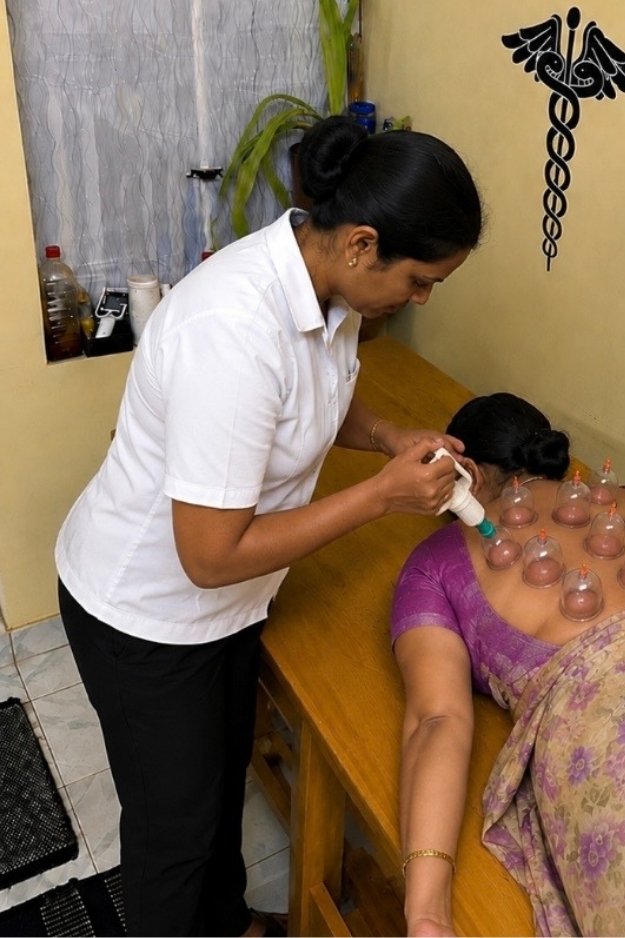 Cupping Therapy Sivakasi